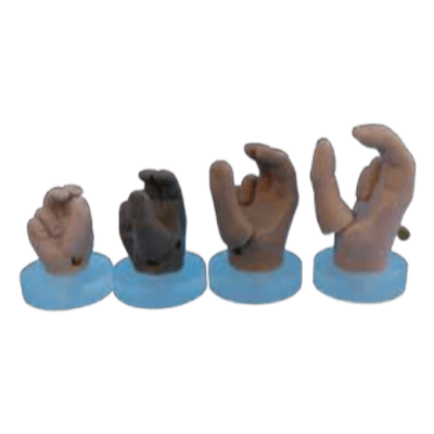 義手 ライトタッチ子供用バイオメカニカルハンド-株式会社小原工業