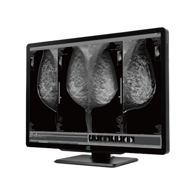 医用画像表示モニター 1,200万画素 30.9型カラー液晶モニター CL-S1200 CL-S1200BGJA-株式会社JVCケンウッド