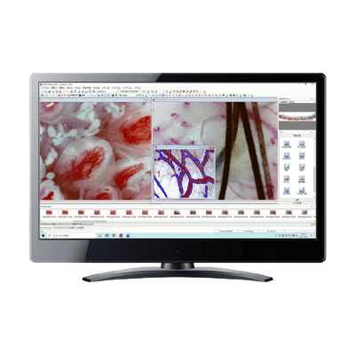 生体の観察・研究を徹底的にサポートする 高機能画像解析計測ソフト GOKO Measure Plus-GOKO映像機器株式会社